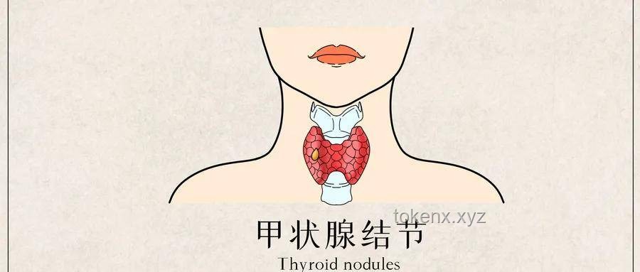 每生一次气都累积在甲状腺：情绪健康与甲状腺疾病趋势预测